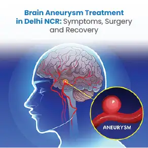 Brain Aneurysm Treatment in Delhi NCR: Symptoms, Surgery & Recovery